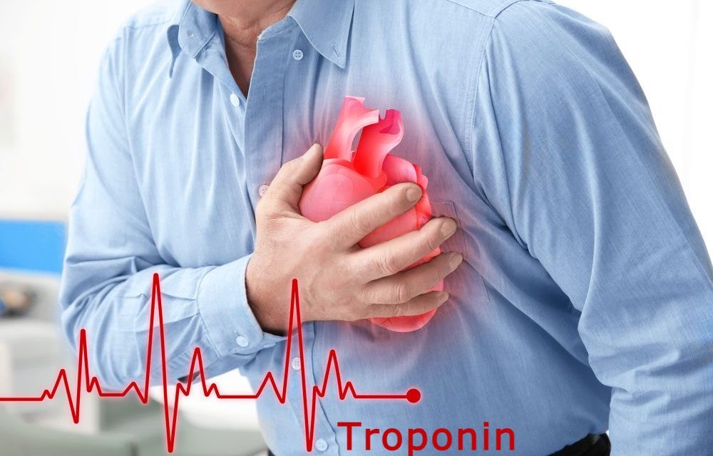 Troponin