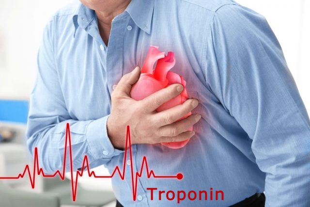 troponin test