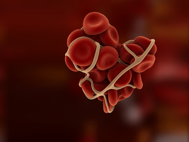 D-dimer labos laboratorij sarajevo