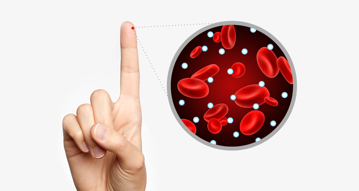 Inzulinska rezistencija