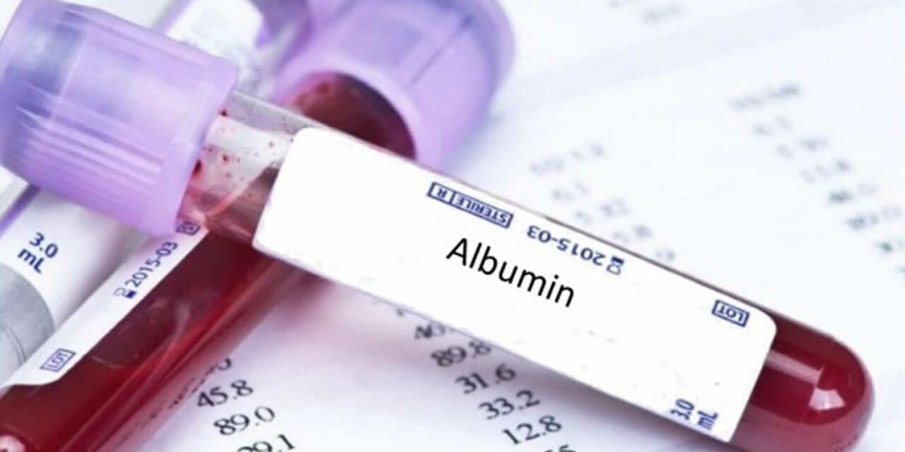 Albumin