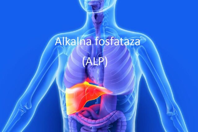 Alkalna fosfataza (ALP)
