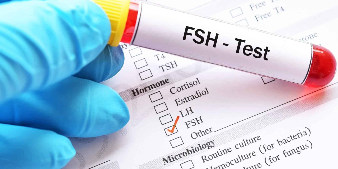 Folikulostimulirajući hormon (FSH)