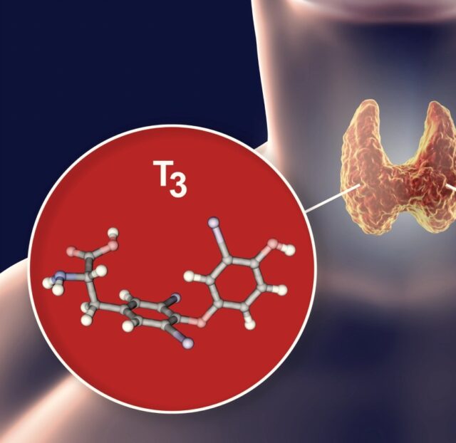 T3 (Trijodtironin)