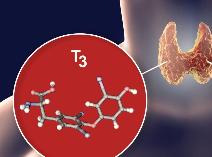 T3 (Trijodtironin)