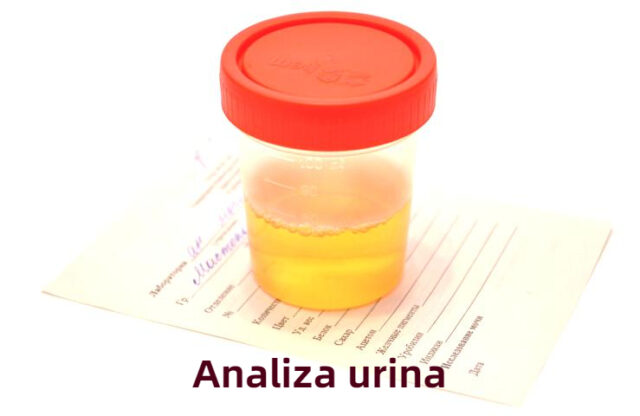 analiza urina