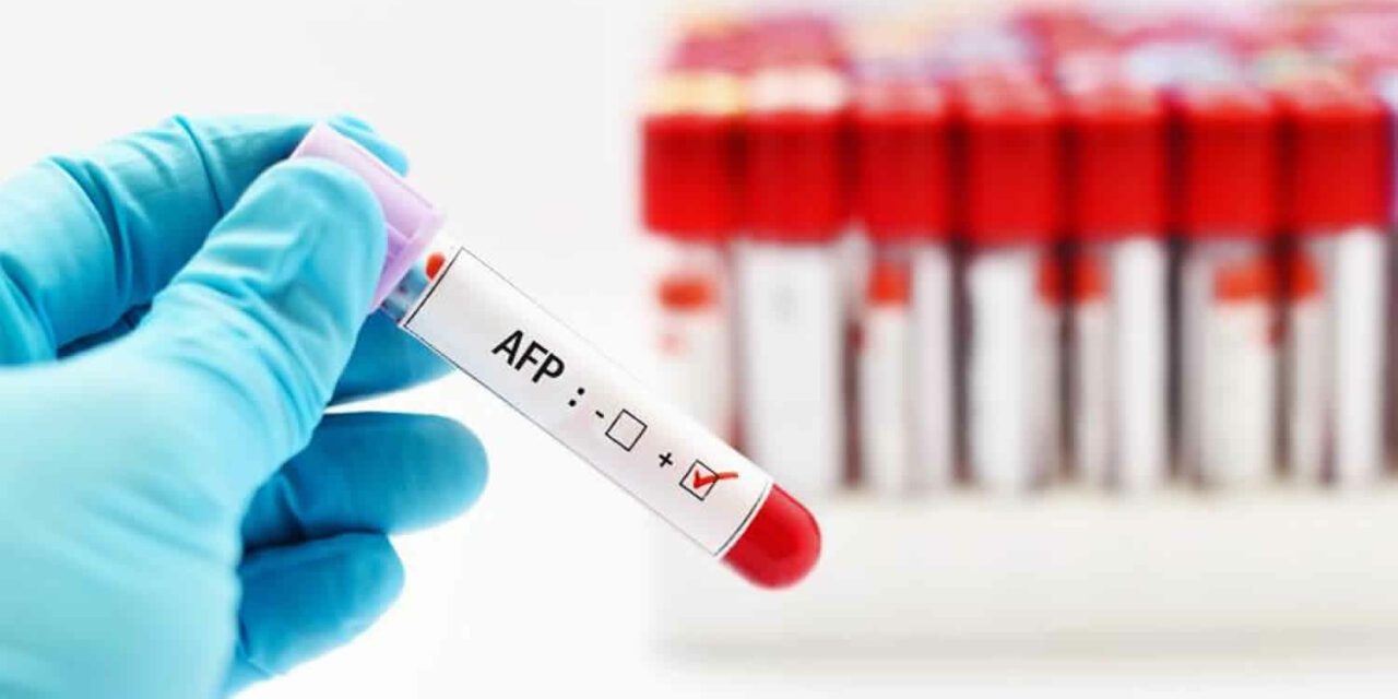 Alfa-fetoprotein (AFP)