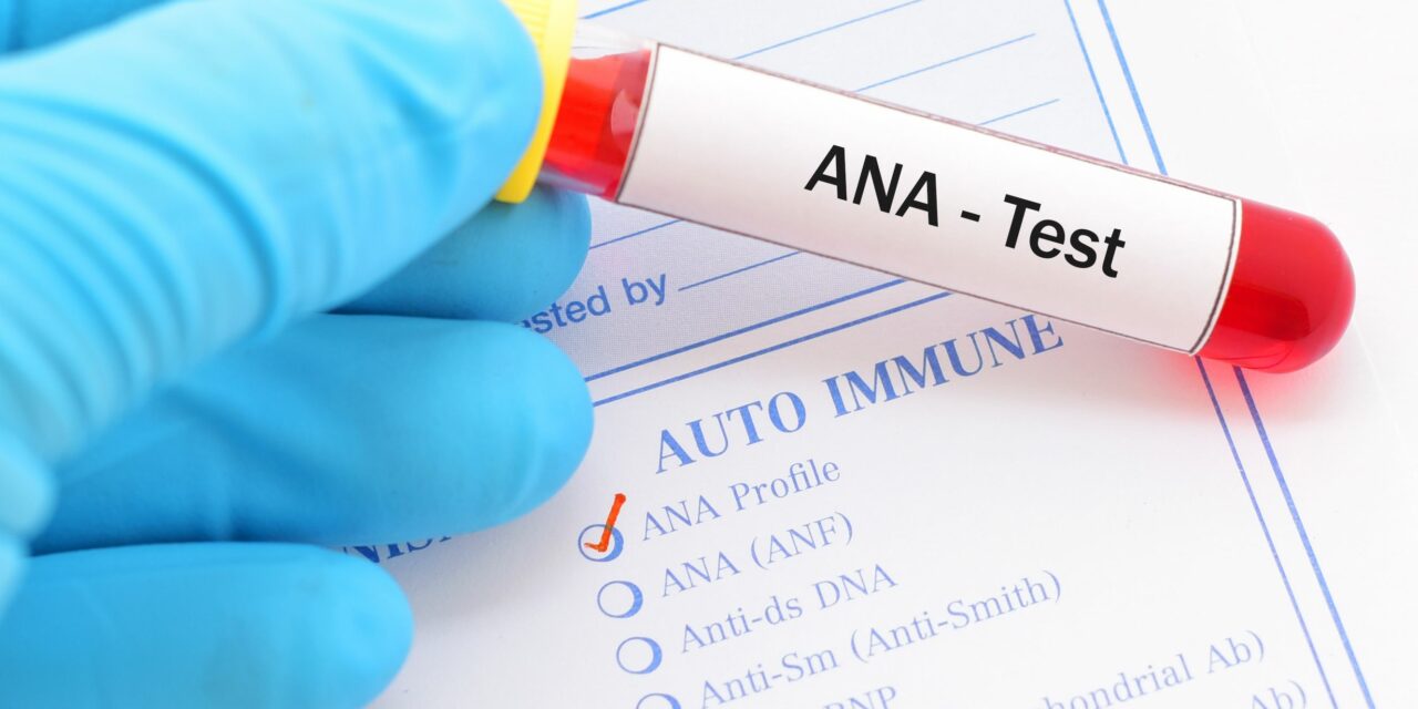 ANA (antinuklearna antitijela)