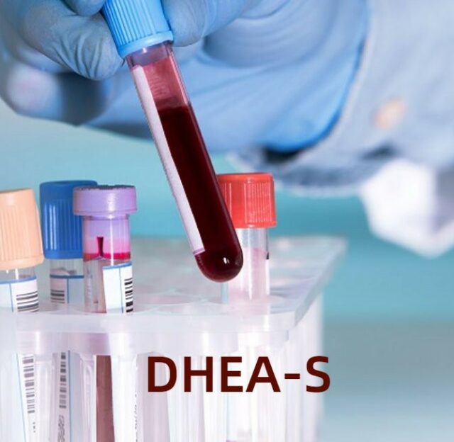 DHEA-S