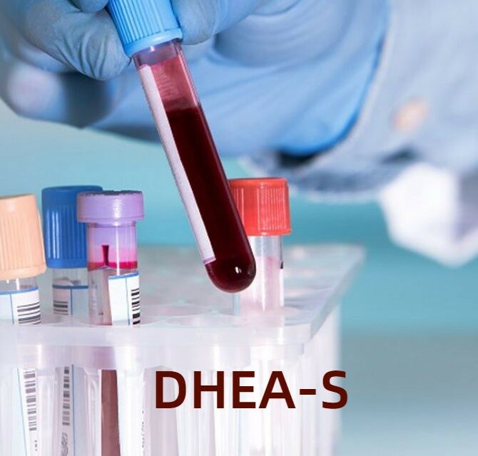 DHEA-S