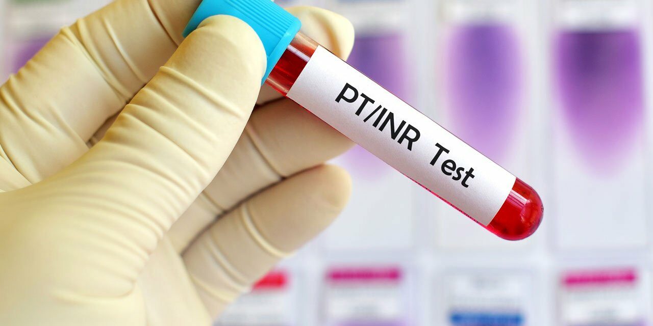 Protrombinsko vrijeme