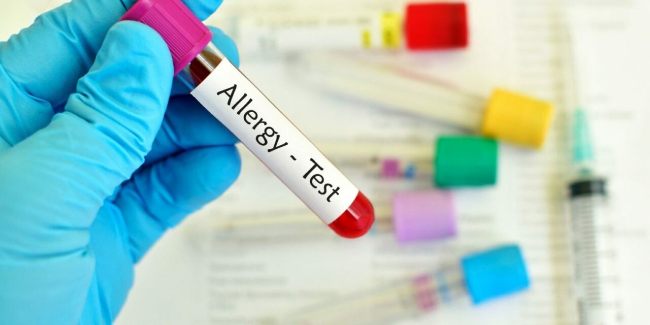 Krvni test na alergije