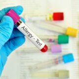 alergijski krvni test