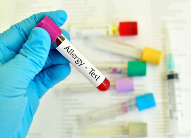 alergijski krvni test