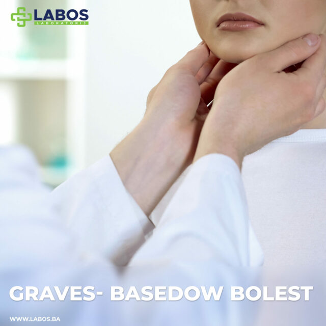 Graves- Basedow