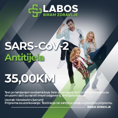 SARS-COVID-19-antitijela